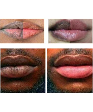 Ranley Brightening Cream for Dark Lips - Effective Lip Lightening Scrub & Balm | Moisturizing & Repairing Formula - Buy Online on GoSupps.com