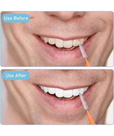 Comnico Interdental Brushes - 50 Pack Tooth Cleaning Tools for Gaps | White Yellow Orange Red Blue - Essential Dental Care - Buy Online on GoSupps.com