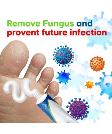 Ketoconazole Antifungal Cream for Men | Fast Relief for Athlete's Foot, Ringworm, Jock Itch & Fungal Infections | 20g - Buy Online on GoSupps.com