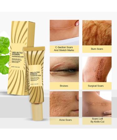 Yuemei Scar Vanishing Cream - Strengthen Skin Repair, Remove Old Scars & Stretch Marks | Suitable for All Skin Types - Buy Online on GoSupps.com