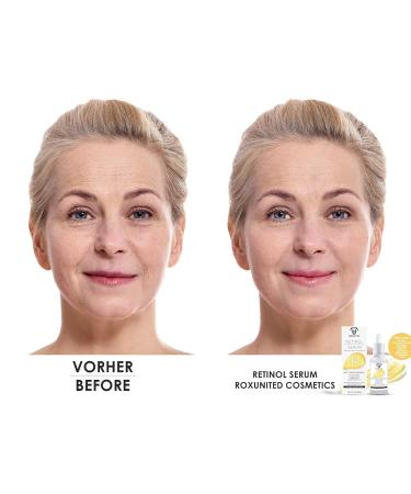 Roxunited Retinol Serum 30 ml - Best Anti-Aging Serum with Vitamin C Vegan Hyaluronic Acid for Wrinkles & Dark Circles - Comparison Winner - Buy Online on GoSupps.com