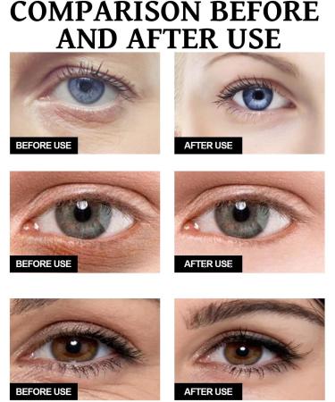 GNAUMORE Celyn eye cream retinol eye cream eye cream against wrinkles and dark circles eye cream against wrinkles anti-ageing eye cream for eye firming cream eye cream against wrinkles for men and women  - Buy Online on GoSupps.com
