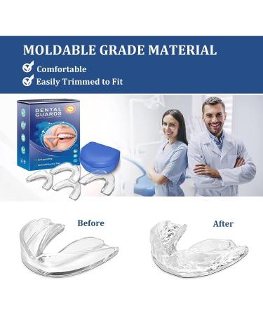 Night Teeth Mouth Guards for Clenching & Grinding - Reusable 4 Piece Set for Sleep - International Shipping Available - Buy Online on GoSupps.com