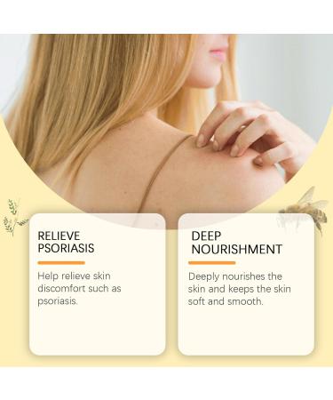 Bee Venom Cream - Bee Venom Wart and Tag Remover - Bee Venom Psoriasis Cream for Soothing - Fast-Acting Relief Psoriasis Treatment Cream - Deep Nourishment & Skin Protection - Buy Online on GoSupps.com