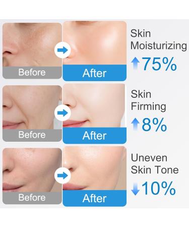 2Pcs SilkPeptide Intensive Lifting Ampoule Collagen Peptide Intensive Lifting Serum Korean Anti Aging Serum for Face Tightening Lifting Smoothing Hydrating 100ML - Buy Online on GoSupps.com