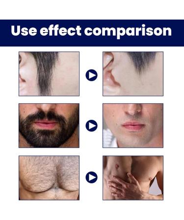  Generisch Hair removal cream for men penetrates hair follicles quickly - 60 ml - Painless hair removal cream for face chest back arms legs underarms - Buy Online on GoSupps.com