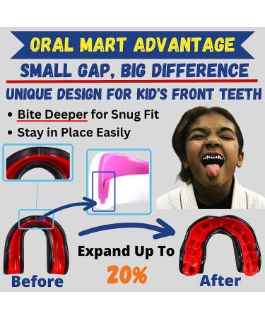 Oral Mart Sports Youth Mouth Guard for Kids (USA Flag & 3 Fangs & 15 Best Colors) | Youth Mouthguard (BPA Free) Football  MMA  Karate  Flag Football  Rugby  Boxing  BJJ  Hockey (/w Vented Case) (Youth  Strapless) Youth (Age 12 & Below) Pinky Lady - Buy Online on GoSupps.com