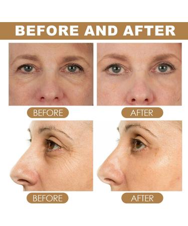  JASUBAI Set of 2 anti-aging eye creams retinol eye cream for dark circles and puffiness eye treatment serum with retinol and collagen firming eye cream - Buy Online on GoSupps.com