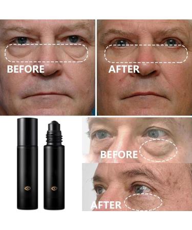 WJnflQN Under Eye RollerStick For Clear Looking Eyes 10ml Nongreasy Rollon Skin Repair Stick for Night Daily Use Travel and Makeup Preparation - Buy Online on GoSupps.com