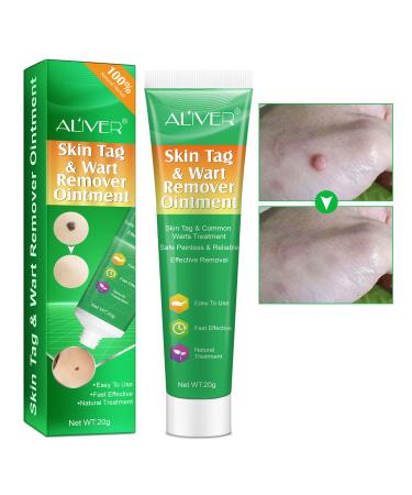 GNAPY Skin Tag Removal Warts Remover Cream Advanced Skin Tag Remover Treatment Formula Natural Ingredients Wart & Mole Removal Treatment for All Skin Type 20G (1g)