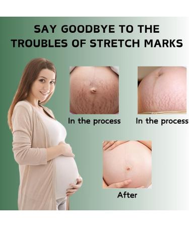 Body Oil for Women - Body Skin Care - Body Oil for Stretch Marks Removal - Moisturizing Firming Nourishing Body Oil - Stretch Mark Oil - Reduce Fine Lines & Restore Skin Elasticity - Mum to Be Gifts - Buy Online on GoSupps.com