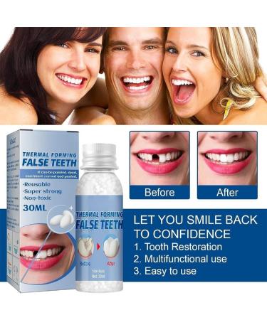 Tooth Filling Repair Kit for Temporary and Broken Teeth - Dental Repair Beads for Dentures and False Teeth - Buy Online on GoSupps.com