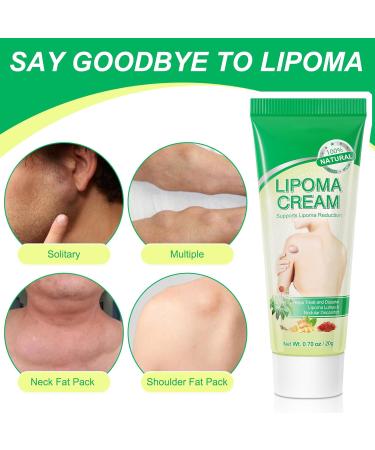 Lipoma Elimination Cream Lipoma Removal Cream Cr me D' limination des Lipomes V g taux limination Douce Des Lipomes 2pc - Buy Online on GoSupps.com