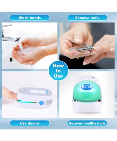VENDELLA Nail Fungus Laser Treatment Device Portable Light Therapy Fungus Nail Treatment Toenail Fungus Treatment with Blue & Infrared Light Home-Use for Damaged Discolored Thickened Fingernails - Buy Online on GoSupps.com