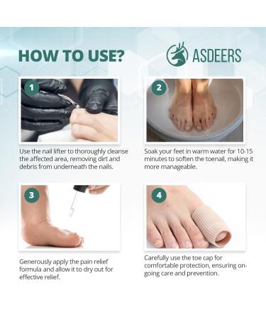 Ingrown Toenail Treatment - Easy Home Removal Kit for Men & Women | Nail Reliever & Softener Tools - Buy Online on GoSupps.com