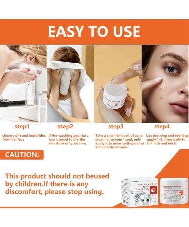 Azelaic Acid Face Cream Azelaic Acid 15% Facial Serum Cream Azelaic Acid Acne Cream Gentle Niacinamide&Vitamin C for Redness Face Dark Spot Rosacea Skin Care Beauty for Face or Body(30G) - Buy Online on GoSupps.com