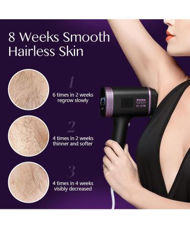 IPL Hair Removal Device with Infinite Flashes - 2 Attachments for Face, Body, Bikini Lines - Corded - Buy Online on GoSupps.com