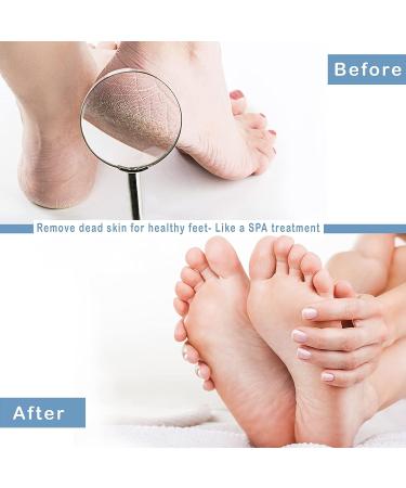 Wall-Mounted Silicone Shower Back Scrubber with Suction Cups - Pink | Body & Foot Scrubber with Hook for Men and Women - Buy Online on GoSupps.com