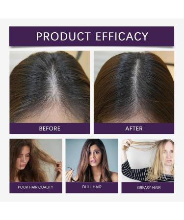  yikaiszh Rosemary Hair Serum - Vitamin E Scalp Care Oil - Anti-Dryness Growth Serum - More Powerful - Thinning Essence - Repair for Shiny Hair - For All - Buy Online on GoSupps.com