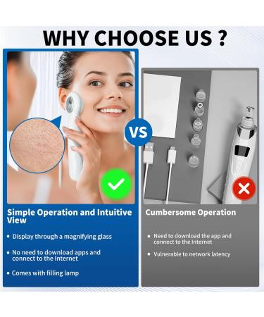 ALLBIZ Newest Blackhead Remover Pore Vacuum Upgraded Pore Cleaner with Visible Magnifying Glass Comedone Whitehead Remover Tool Set 3 Modes 6 Probes - Buy Online on GoSupps.com