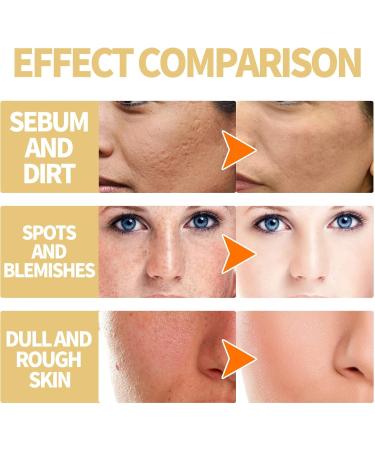 DUBUSH 50 ML Exfoliating Body Oil Yellow Brightening Body Exfoliating Oil Powerful Exfoliating Oil Dark Skin - Buy Online on GoSupps.com