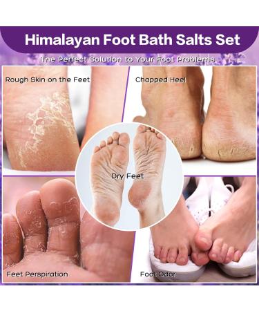Himalayan Pink Salt Foot Soak Set - Lavender Orange & Rose - Epsom Bath Salts for Athletes' Foot & Itching Relief - Essential Foot Care - Buy Online on GoSupps.com