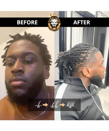 Mane Might Hair Growth Oil Hair Loss Treatment with Rosemary Castor Jojoba Argan & Tea Tree Oil 100% Natural Formula for Hair Growth & Thickness 118ml - Buy Online on GoSupps.com