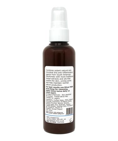 Buy Silver MSM Acne Lotion 100ml - Natural Acne Treatment for Clear Skin | International Shipping Available - Buy Online on GoSupps.com
