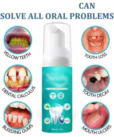 Smile Bright Mouthwash - Smartsmile Tooth Whitening & Rebuilding (3PCs) | International Shipping Available - Buy Online on GoSupps.com