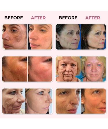 Abera Skin Renewing Serum For Anti-Wrinkle Melasma Treatment Anti-Aging For Face High Potency Saffron Extract Lavandula Stoechas Extract Hydrating Serum 1.01 Fl Oz - Buy Online on GoSupps.com