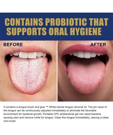 Premium Tongue Scraper & Brush - Enhance Oral Hygiene Freshen Breath & Remove Coating | International Shipping Available - Buy Online on GoSupps.com