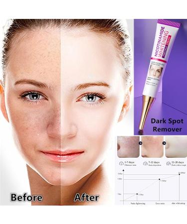 Dark Spot Remover & Skin Lightening Cream - Brightening Treatment for Face & Body | Freckle & Hyperpigmentation Corrector - 0.71oz - Buy Online on GoSupps.com
