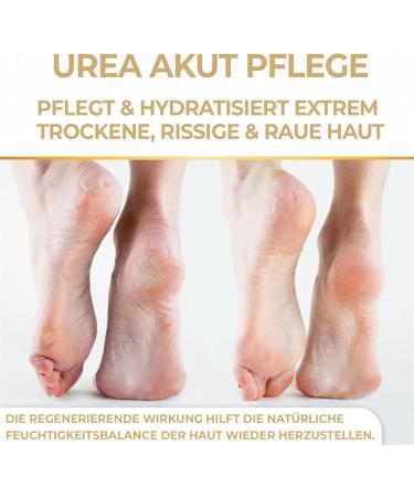 Fallea Callus & Cracked Skin Balm 25% Urea - 200 ml + 2 Pairs Socks (40-44) | Fast International Shipping - Buy Online on GoSupps.com