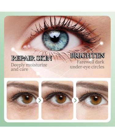 60 PCS Aloe Vera Under Eye Patches - Eliminate Dark Circles & Fine Lines | Hydrating Eye Masks with Natural Extracts for Youthful Skin - Buy Online on GoSupps.com