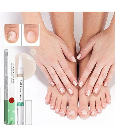 Nail Growth Oil | Repair Damaged Nails Add Shine Strengthen Nail Moisturizer Strengthener Nail Renewal Liquid Nail Growth Oil Nail Care Nail Growth Oil Nail Care Pen Nail Nourishing Care Nail Oil - Buy Online on GoSupps.com