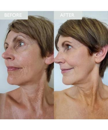 SKINICIAN Advanced Firming Serum for Mature Skin - Anti-Ageing Face Serum for Reducing Appearance of Fine Lines - High Performance Peptide Serum - Vegan & Cruelty Free Face Moisturiser (50ml) - Buy Online on GoSupps.com