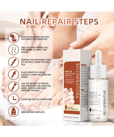 Nail Growth and Strengthening Serum 20ml Nails Repair Serum Fungal Nail Treatment for Toenail Extra Strong Toenail Growth Treatment for Repairing Damaged and Discolored Nails Improve Onychomycosis - Buy Online on GoSupps.com