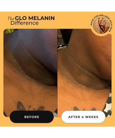 Glo Melanin Magic Eraser Dark Spot Cream for Face, Body & Sensitive Areas - inner thighs remover Made in USA - Faded Cream for Black Spots 1.7 Oz - Buy Online on GoSupps.com