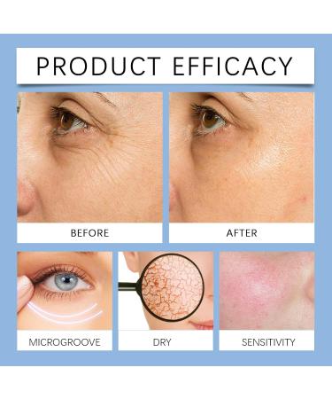 Boto-X Stock Solution Boto-X Stock Anti Aging Serum For Face Boto-X Face Serum UK Collagen Serum for Face Anti Aging Serum for Face Anti-Wrinkle Serum Hydrate & Plump Skin & Reduce Wrinkles - Buy Online on GoSupps.com