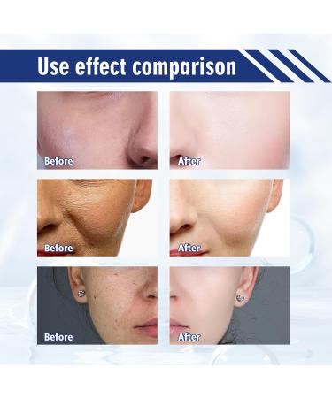 Niacinamide Serum Brightening Serum Dark Spot Remover for Face Face Serum for Dry Skin Age Spot Remover For Face Face Redness Remover Fades Dark Spot Boost Skin Collagen Hydrate & Brighten - Buy Online on GoSupps.com