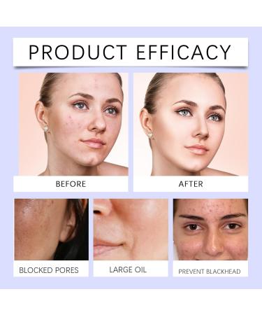 Hydrating Toner: Oil Control Pore Minimizing Quick Absorption Gentle & Long-Lasting Moisture(1PCS) - Buy Online on GoSupps.com