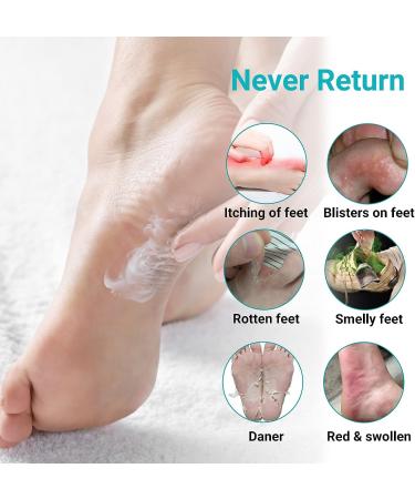 LMNOOP Athletes Foot Treatment Cream Maximum Strength - Antifungal Foot Cream for Itching, Blister, Burning, and Cracking - Natural Herbs - 1.76oz - Buy Online on GoSupps.com