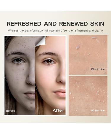 MEITREND Peel Shot Glow Rice Ampoule peelshot Black Rice Ampoule black rice as peeling rice peeling for the face moisturizing blackhead remover and facial peeling - Buy Online on GoSupps.com