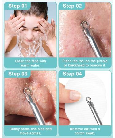 EZBASICS Blackhead Remover Tools - Stainless Steel Comedone Extractor Set for Blemish and Whitehead Popping - Buy Online on GoSupps.com