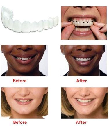 Giural Comfort Fit Flex Dentures - Instant Perfect Smile Veneers | Snap-On Cosmetic Teeth Prosthesis (2 Pairs) - Buy Online on GoSupps.com