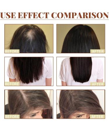Raw Batana Oil for Hair Growth Hair Butter with Pure Batana Oil Natural Hair Growth Oil Effective Against Regional Alopecia Soothe Scalp 100ml - Buy Online on GoSupps.com