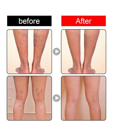 Moon Cheese Care Foot Relief Serum 1 Fl Oz - Promotes Smooth Skin and Blood Circulation - Buy Online on GoSupps.com