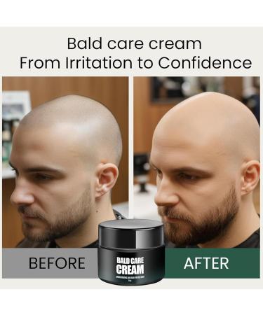  Generisch Men's shaving cream - Scalp care - Moisturizing and repairing - Nourishing baldness cream with UV protection - Protects your scalp health - Suitable for baldness - Buy Online on GoSupps.com