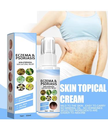 DUBUSH Herbal Psoriasis Soothing Spray - Vitiligo & Psoriasis Treatment Relief - Repair Eczema, Soothe Skin - Face & Body - 3-Pack - Buy Online on GoSupps.com