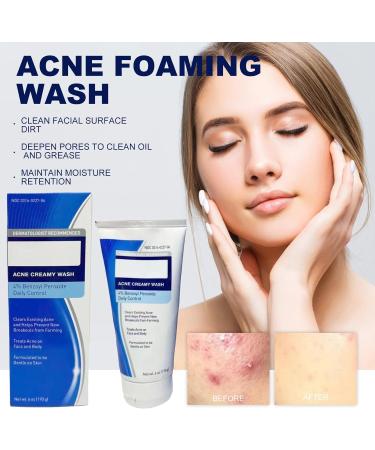  Luthasolic Akne Clean Foam Cleanser 170 g Acne Foaming Wash Akne Gentle Facial Cleansing Foam Deep Pore Cleansing Foam for Facial Cleansing Against Makeup Dirt (4%) - Buy Online on GoSupps.com